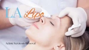 Woman receiving Actinic Keratosis Removal Treatment Redhill