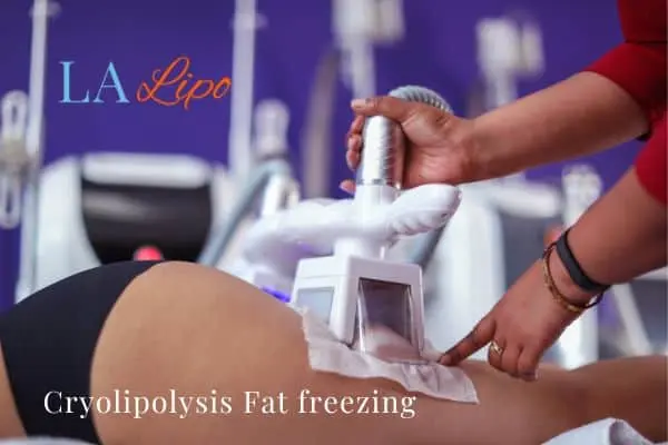 women getting fat freezing Redhill
