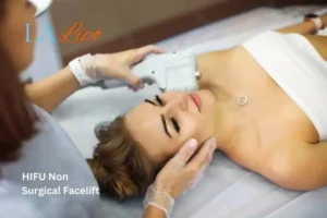 Woman having Hi-Fu to reduce wrinkles Redhill.