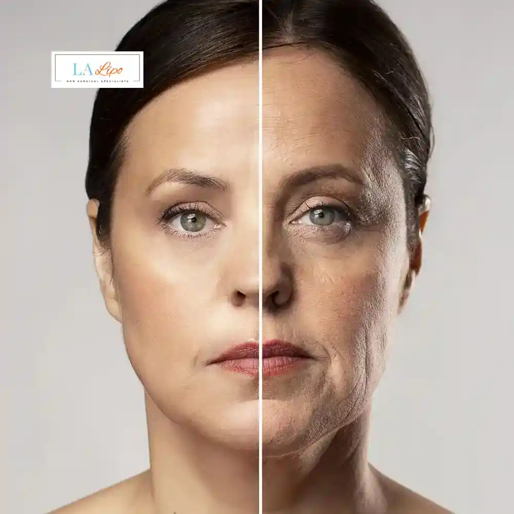 How Can You Tell If Non-Surgical Skin Tightening Is Right for You Redhill?