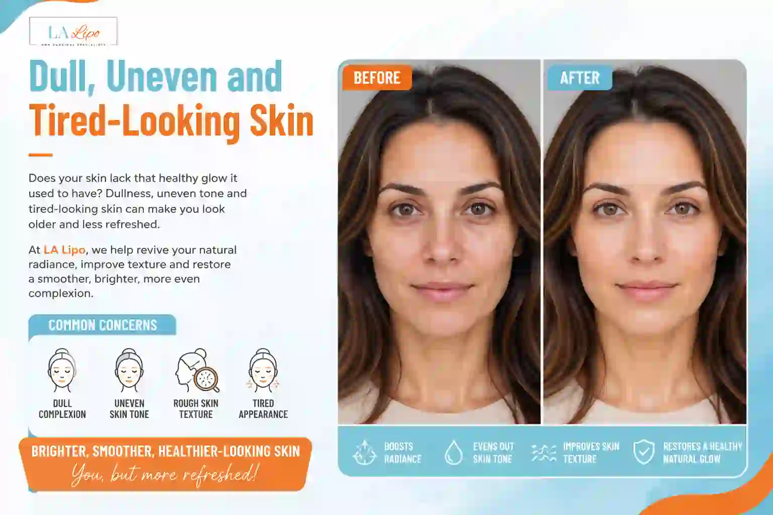 Sign #5: Dull, Uneven and Tired-Looking Skin Redhill