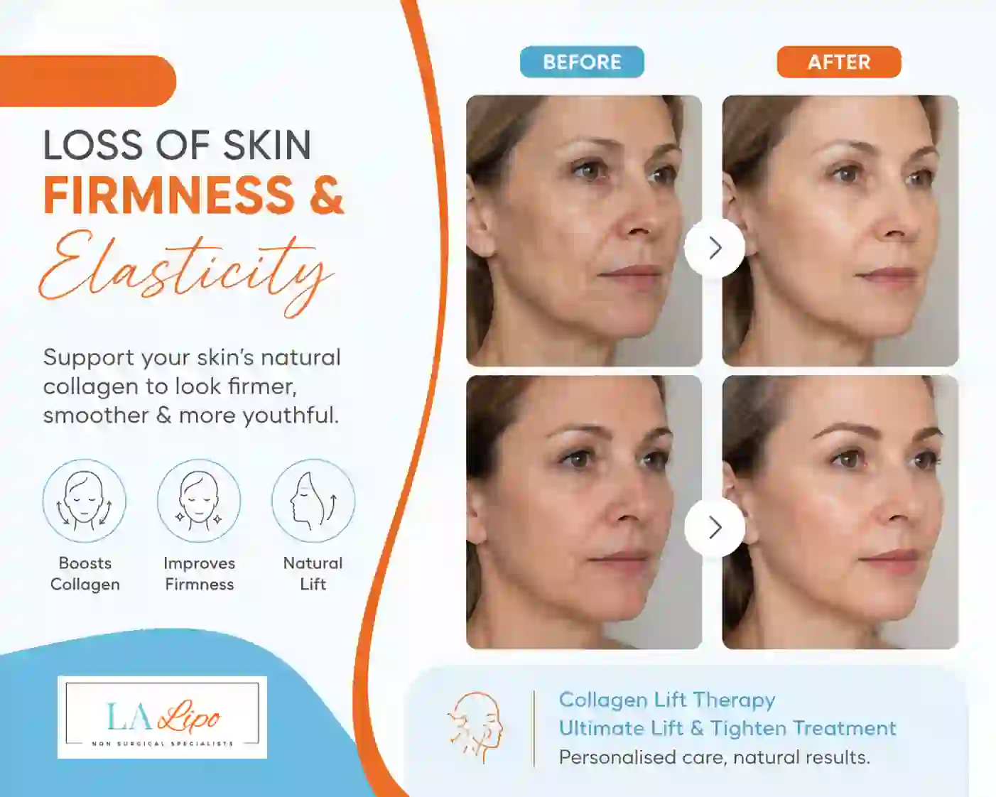 Sign #7: Loss of Skin Firmness and Elasticity Redhill