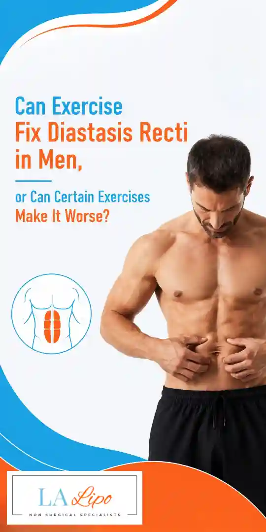 Can Exercise Fix Diastasis Recti in Men, or Can Certain Exercises Make It Worse Redhill?